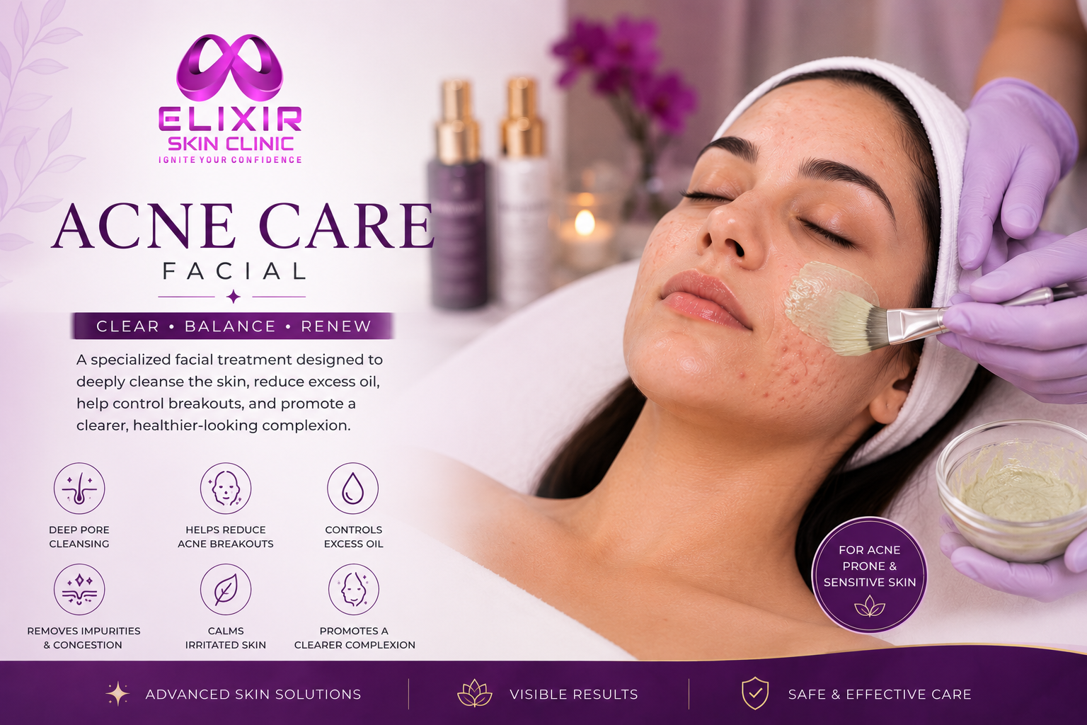 Acne Care Facial